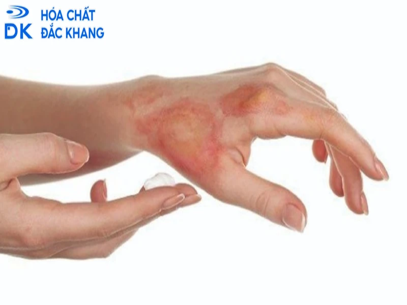 Tính chất nguy hiểm của axit sunfuric cần đặc biệt lưu tâm