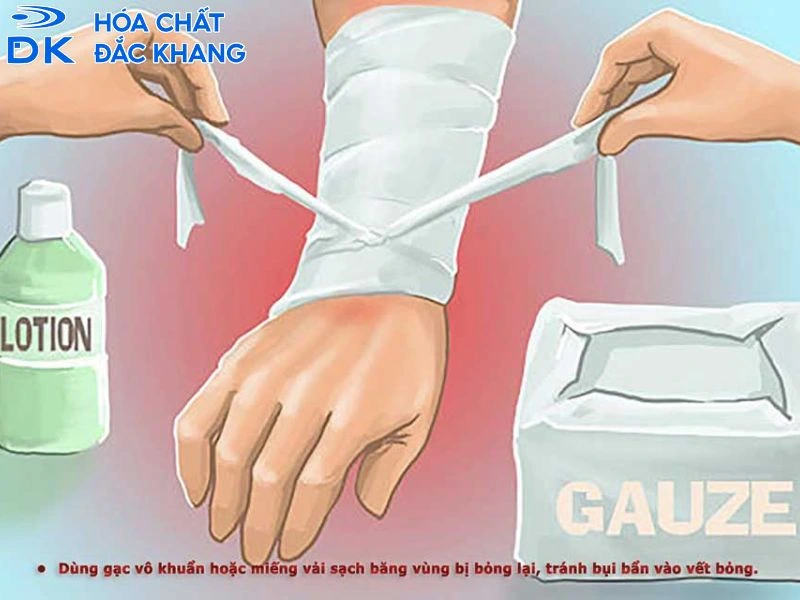 sơ cứu khi bị bỏng axit h2so4