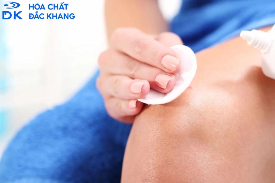 Có Nên Dùng Oxy Già Rửa Vết Thương Không? Giải Đáp Từ Góc Độ Hóa Học
