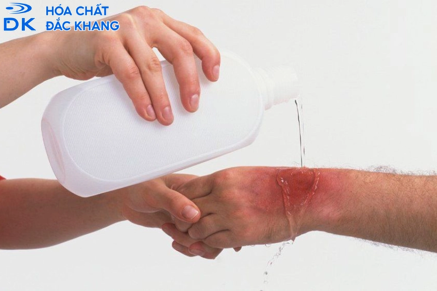 Cồn công nghiệp có dùng để sát khuẩn được không? Hướng dẫn chọn nồng độ và an toàn