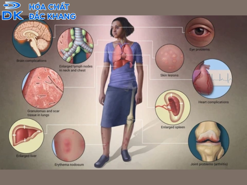 ngửi lưu huỳnh có độc không
