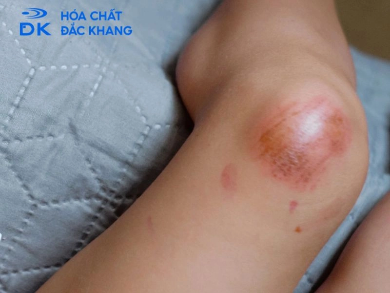 Bảo quản và vận chuyển xút lỏng