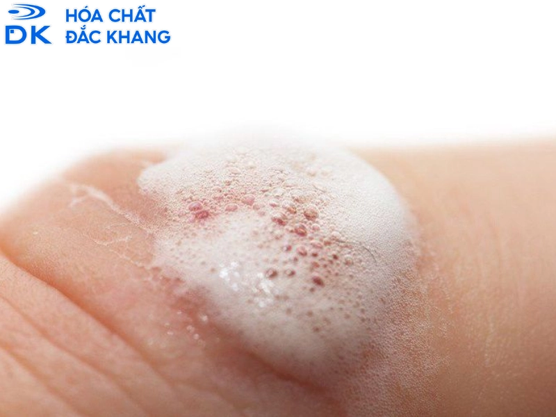 tác hại của oxy già
