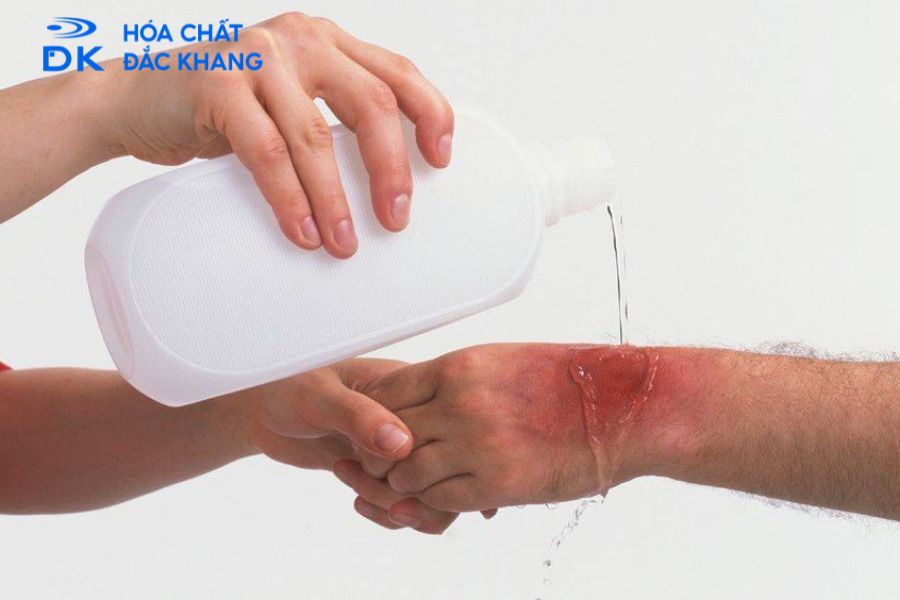 Cồn Công Nghiệp Có Sát Khuẩn Được Không? Lưu Ý Từ Chuyên Gia