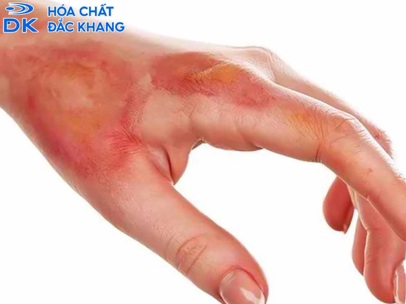 axit sunfuric có độc không axit sunfuric có độc không